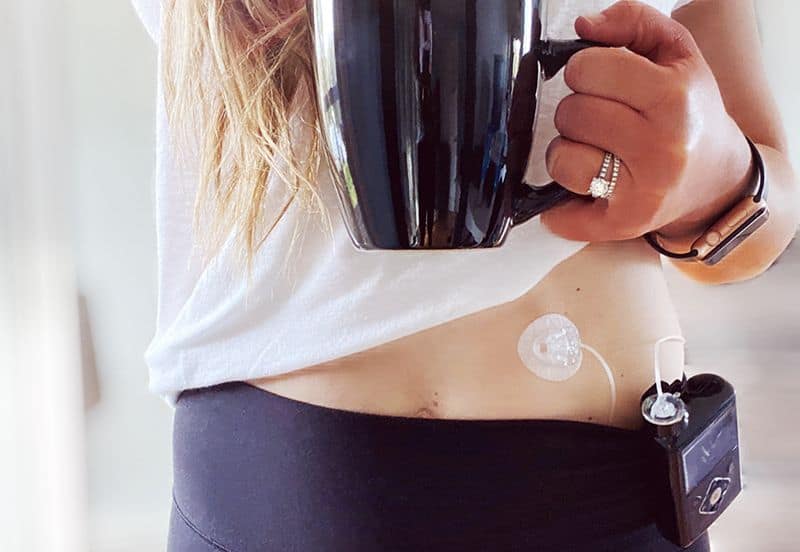 Erica Mackay sosteniendo una taza y mostrando su bomba de insulina