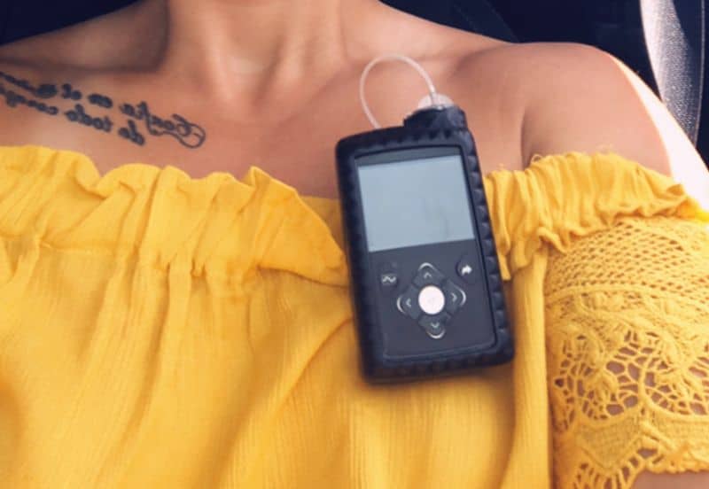 Mariana Marquez zeigt ihre Insulinpumpe