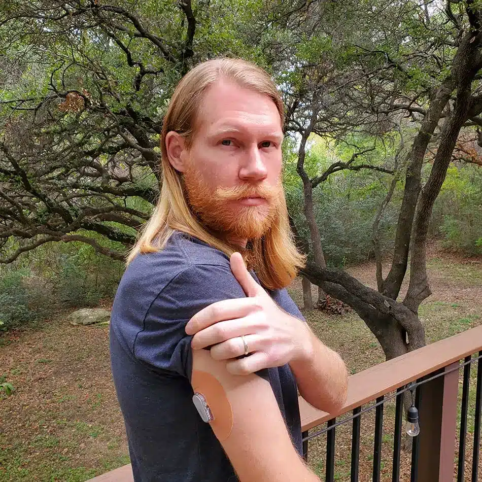 Jarrod Dickenson Showing His Cgm